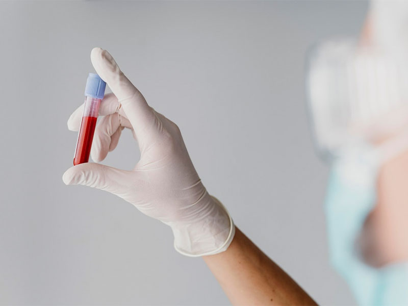 Pessoa segurando uma amostra sanguínea