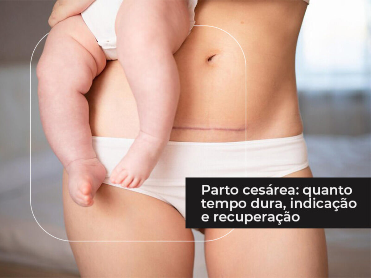 Parto cesárea: quanto tempo dura, indicação e recuperação