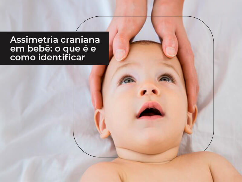 Assimetria craniana em bebe
